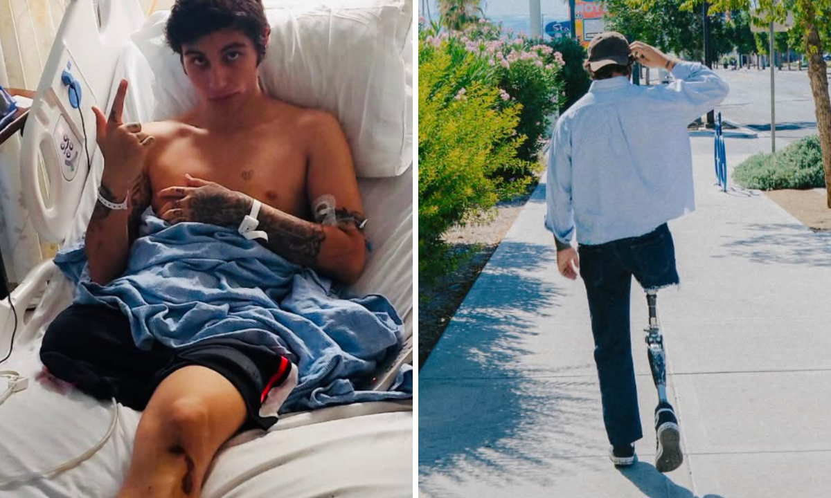 At 16, I Jumped on the Train Tracks. The Consequences Were Devastating