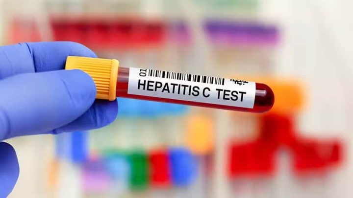 Govt Employees to Undergo Mandatory Hepatitis Screening