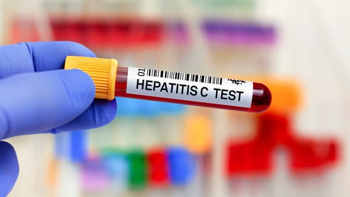 Pakistan Considers Mandatory Hepatitis C Test Before Foreign Travel
