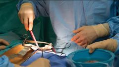 Nearly 3 Crore Pakistanis Are Suffering from Kidney Disease