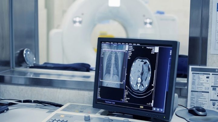 KP to Add MRI and CT Scan Services to More Govt Hospitals