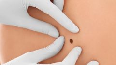 New vaccine prevents deadliest skin cancer from coming back: drugmakers
