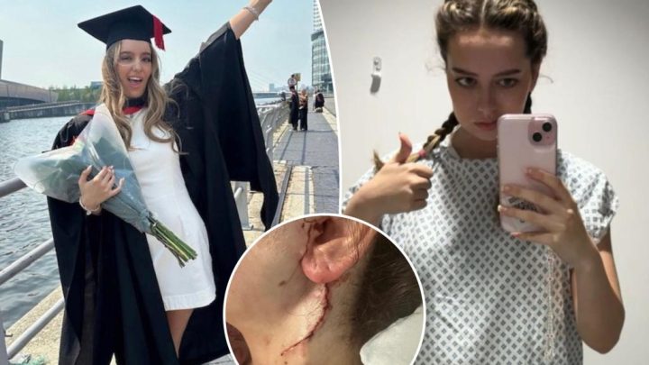 College student unable to move half of her face after emergency surgery to remove rare cancer