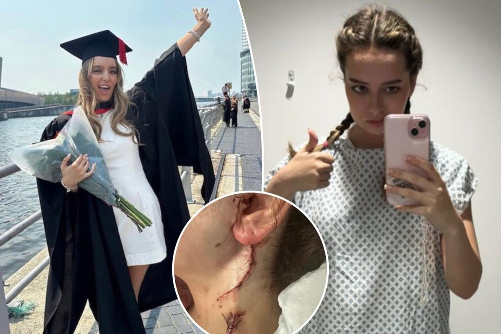 College student unable to move half of her face after emergency surgery to remove rare cancer