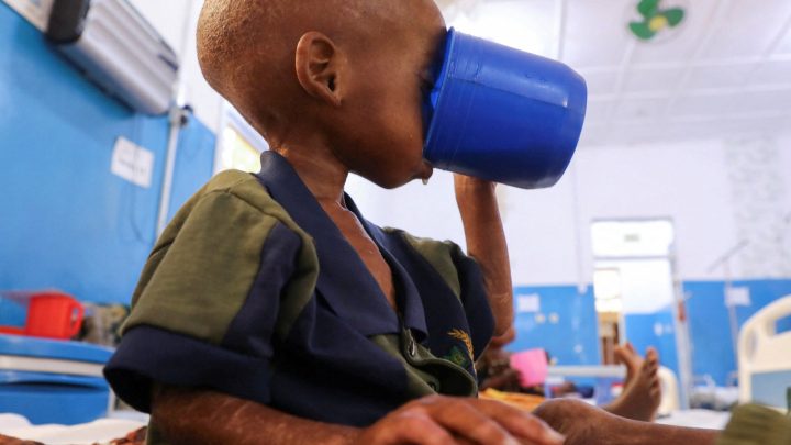Somalia child hunger crisis deepens after aid cuts, UNICEF says