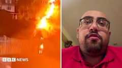 Watch: US man struck by lightning describes 'horrific' experience