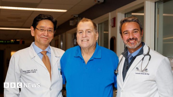 Transplanted pig kidney works in US man's body for record 271 days
