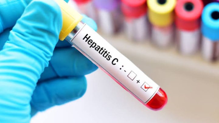 Nationwide Hepatitis C Screening Drive Delayed