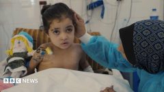 Girl has multiple surgeries to control infections after strike in Gaza