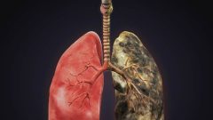 Study Reports Major Trial Success in Lung Cancer