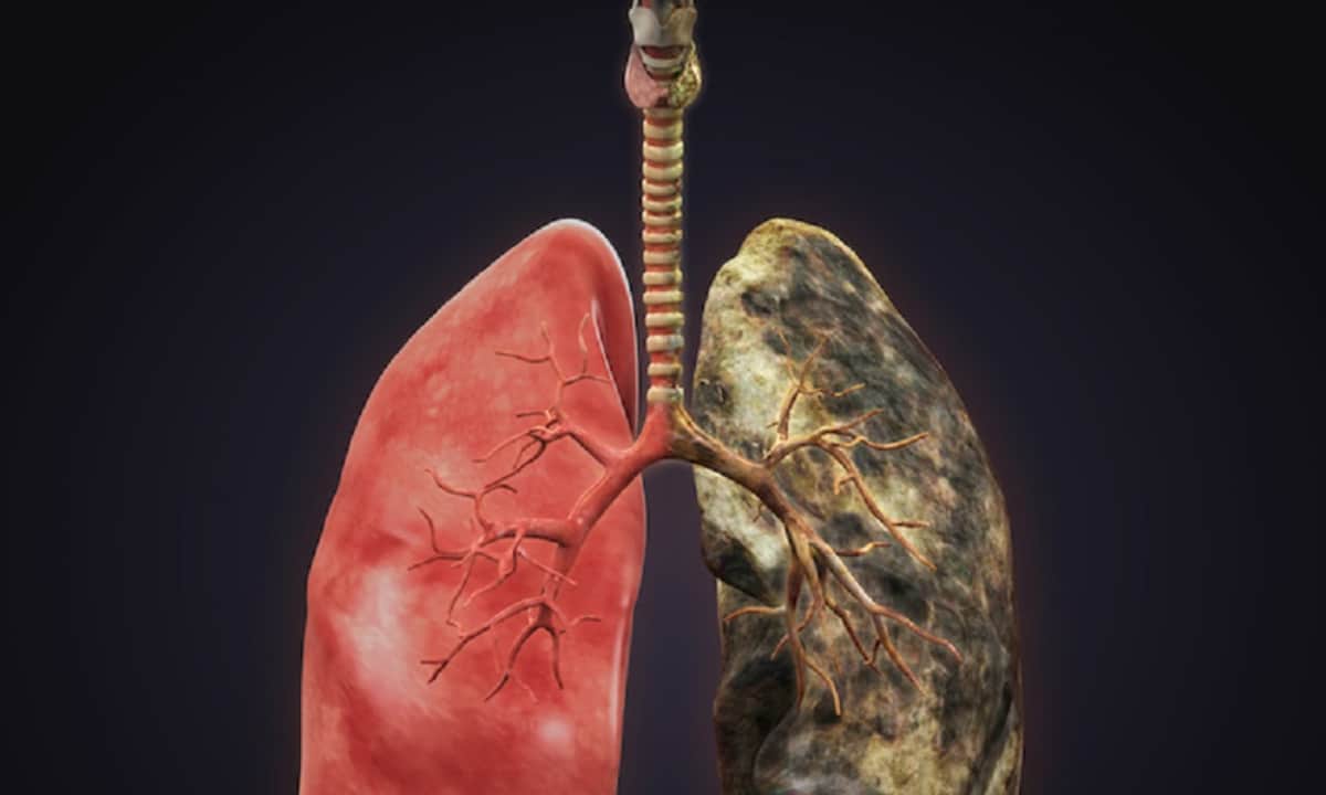 Study Reports Major Trial Success in Lung Cancer
