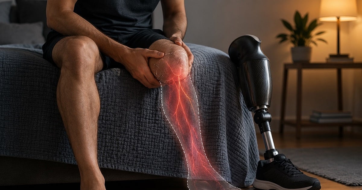 The science behind phantom limb pain