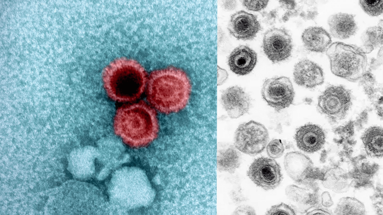 Scientists Develop Antibody for Virus That Infects 95% People
