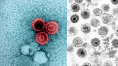 Scientists Develop Antibody for Virus That Infects 95% People