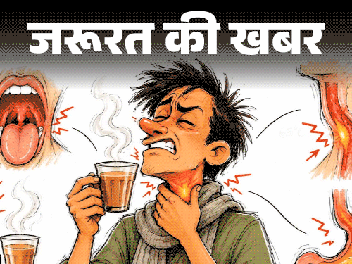 जरूरत की खबर- ज्यादा गरम चाय का शौक खतरनाक: 65°C से ज्यादा गर्म तो बढ़ता कैंसर का रिस्क, चाय, कॉफी, सूप हमेशा ठंडा करके ही पिएं1:29Play video