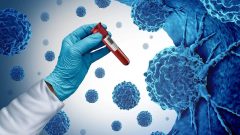 1 in 8 Cancer Cases Worldwide Are Linked to Infections