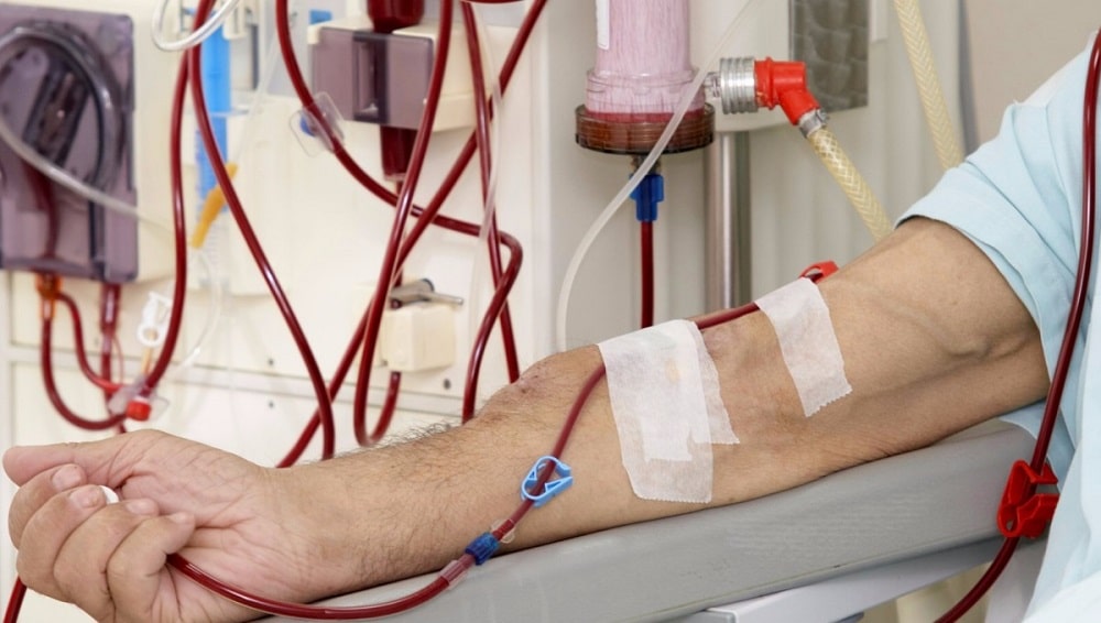 Benazir Bhutto General Hospital Opens Emergency Dialysis Center