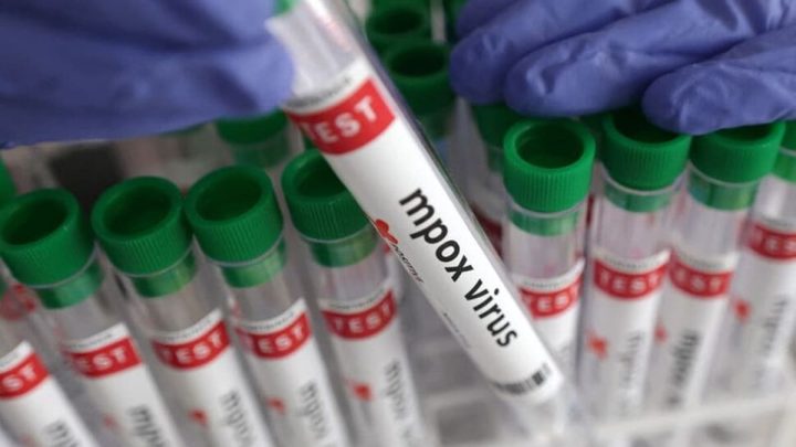 Newborn Tests Positive for Mpox After Circumcision at Karachi Hospital