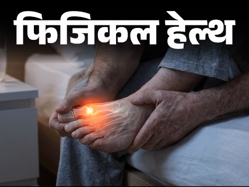 फिजिकल हेल्थ- दुनिया भर में बढ़ रहे ‘गाउट’ के केस: पुरुषों को रिस्क ज्यादा, डॉक्टर से जानें इस बीमारी को कैसे पहचानें, कैसे बचें1:27Play video
