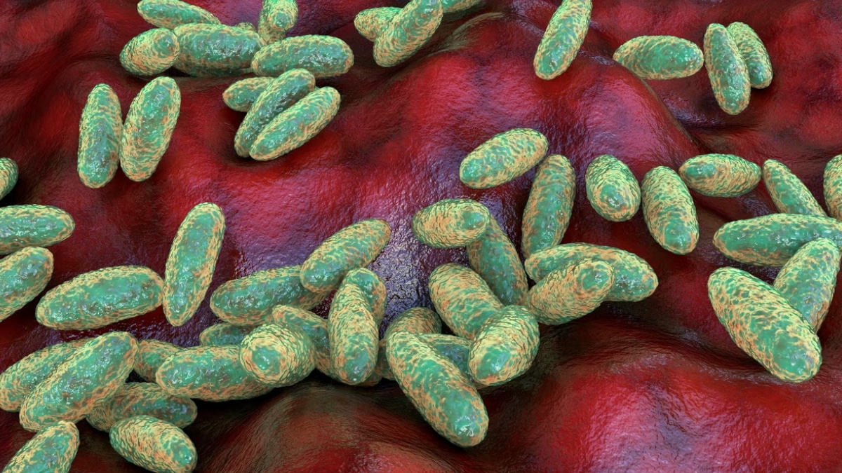 Govt Reveals Chances of Plague Coming in Pakistan From Russia