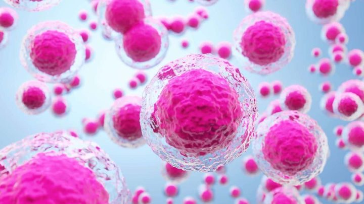 Japan Performs World’s First Stem Cell Treatment for Parkinson’s Disease