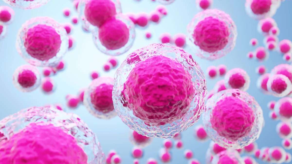 Japan Performs World’s First Stem Cell Treatment for Parkinson’s Disease